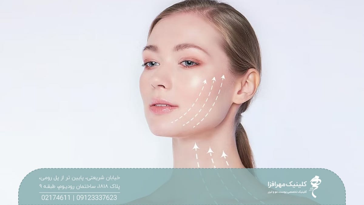 صورت دختری که روی پوست صورت و گردن او چند فلش سفید رنگ به سمت بالا کشیده شده است