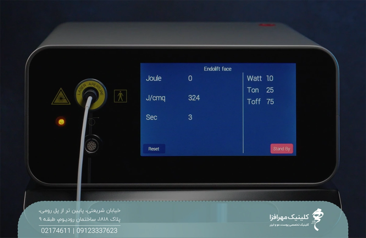 عکس از پنل جلوی دستگاه یوفوتون