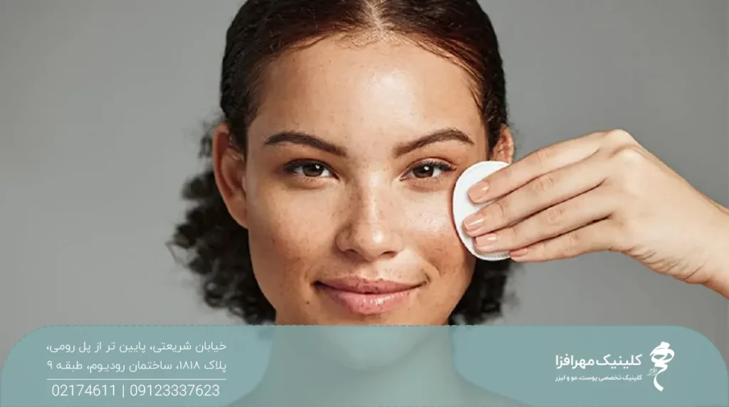 دختر جوان که یک پد را روی گونه خود نگه داشته است - مراقبت بعد از مزوژل صورت