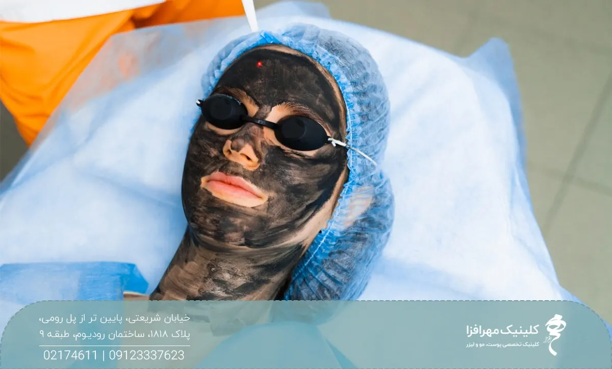 زن در حال انجام پیلینگ