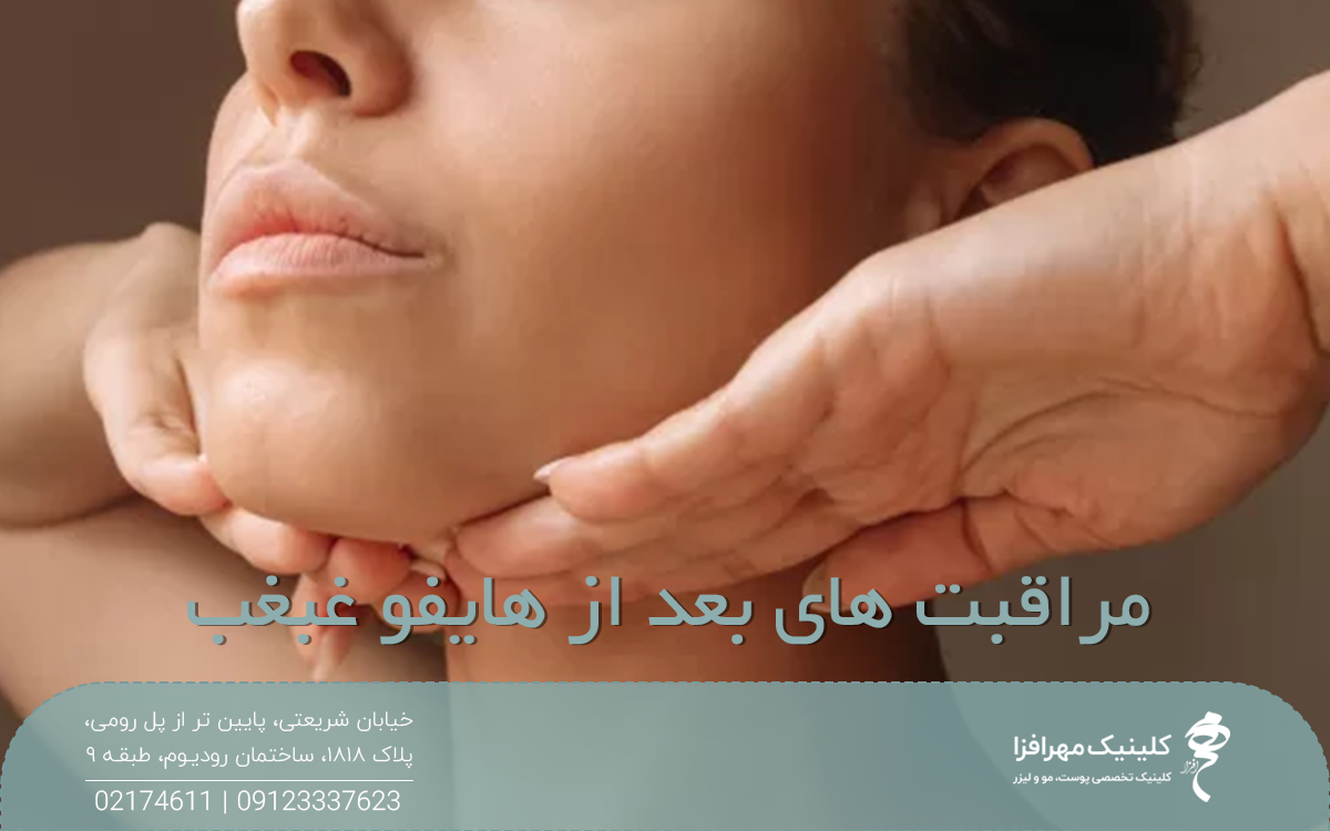 عکس فردی که دو دست خود را زیر چانه اش قرار داده است و روی عکس نوشته شده مراقبت های بعد از هایفو غبغب
