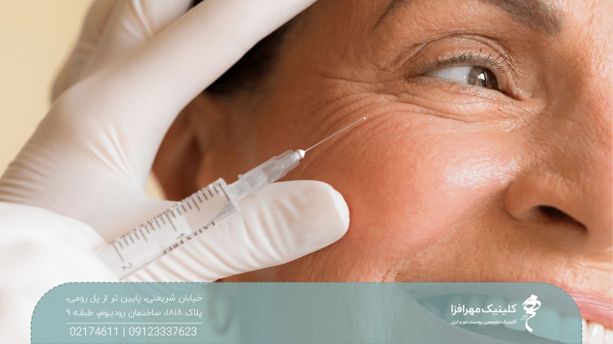عکس نزدیک از صورت زن که پزشک به گوشه چشم او تزریق انجام می دهد