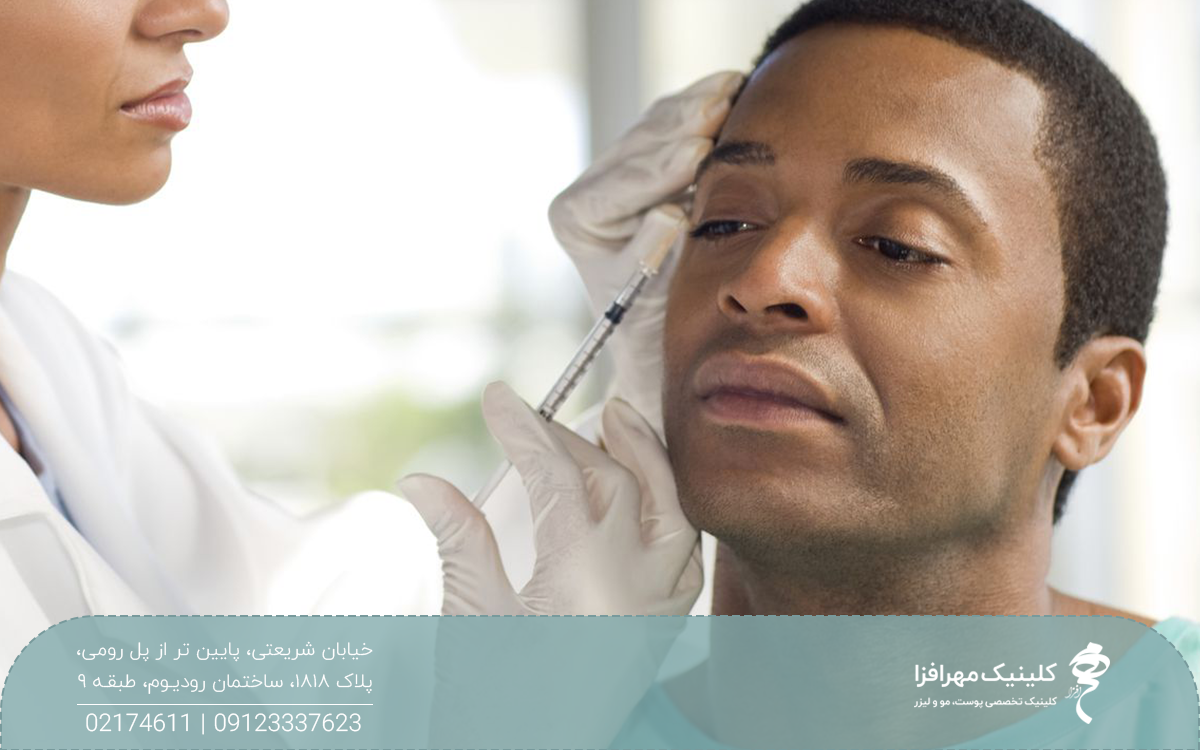 دستان دکتری که درحال تزریق بوتاکس روی ناحیه شقیقه مرد سیاه پوست است
