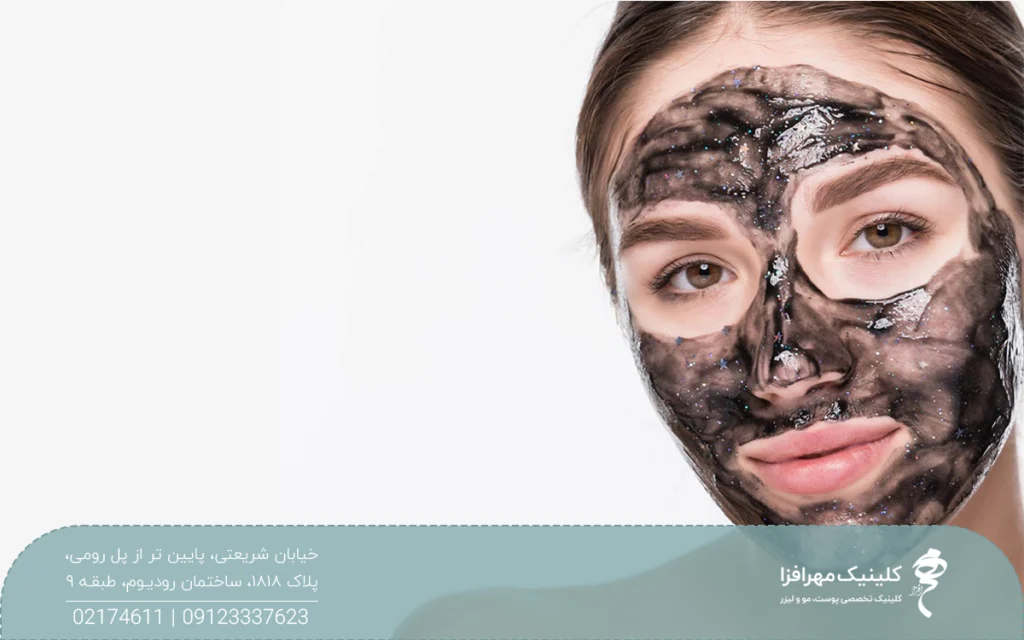 عکس دختری که ژل پیلینگ کربن روی صورتش مالیده است