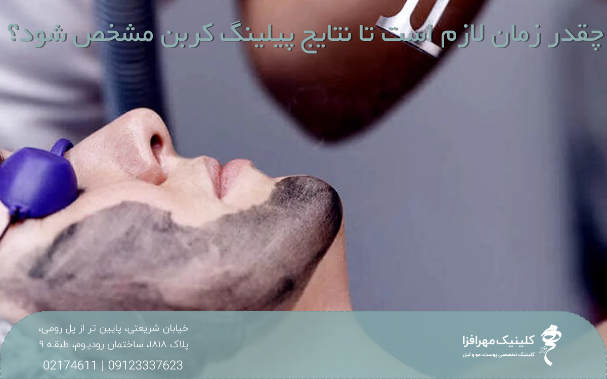 عکس از نیمرخ فردی که عینک مخصوص دارد و روی صورتش ژل پیلینگ کربن است