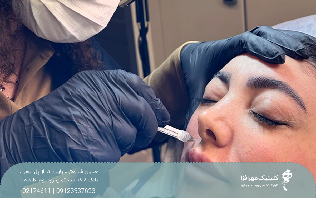 فردی که خوابیده و دستان دکتری که یک دستشش روی پیشانی فرد است و با دست دیگر در حال تزریق مزوژل به خط لبخند او است