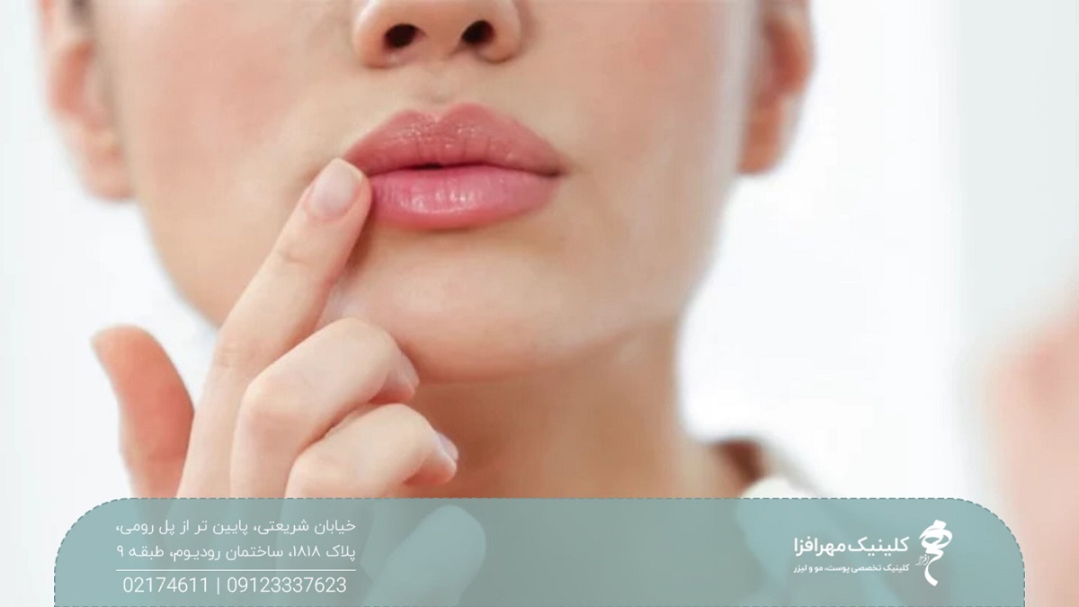 دختر با لب های حجیم که انگشت خود را روی لب هایش گرفته است