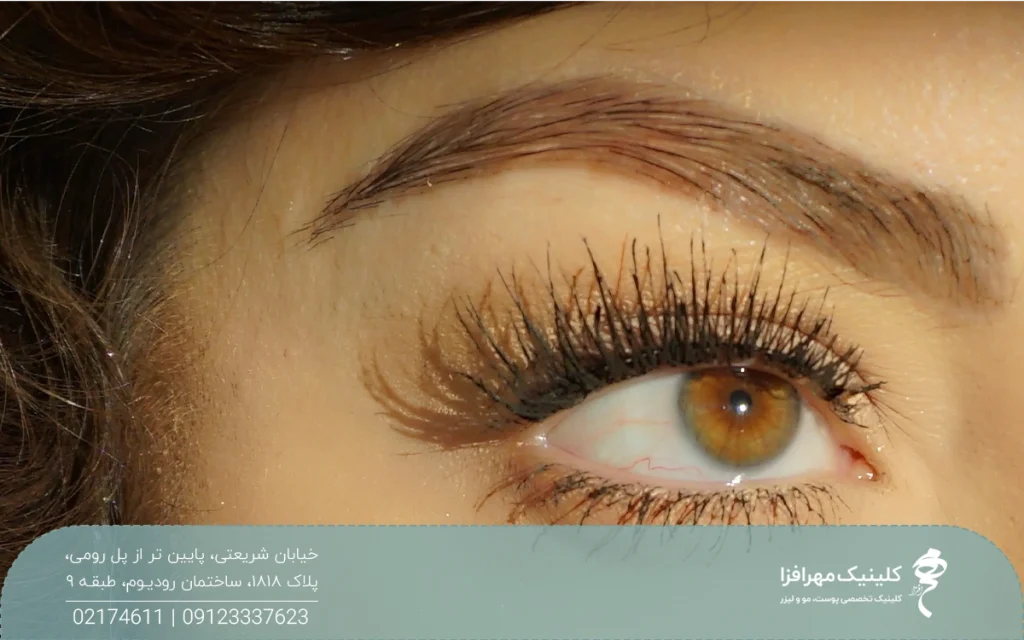 چشم و ابروی دختری که به یک سمت نگاه می کند و ابروی پرپشتی دارد