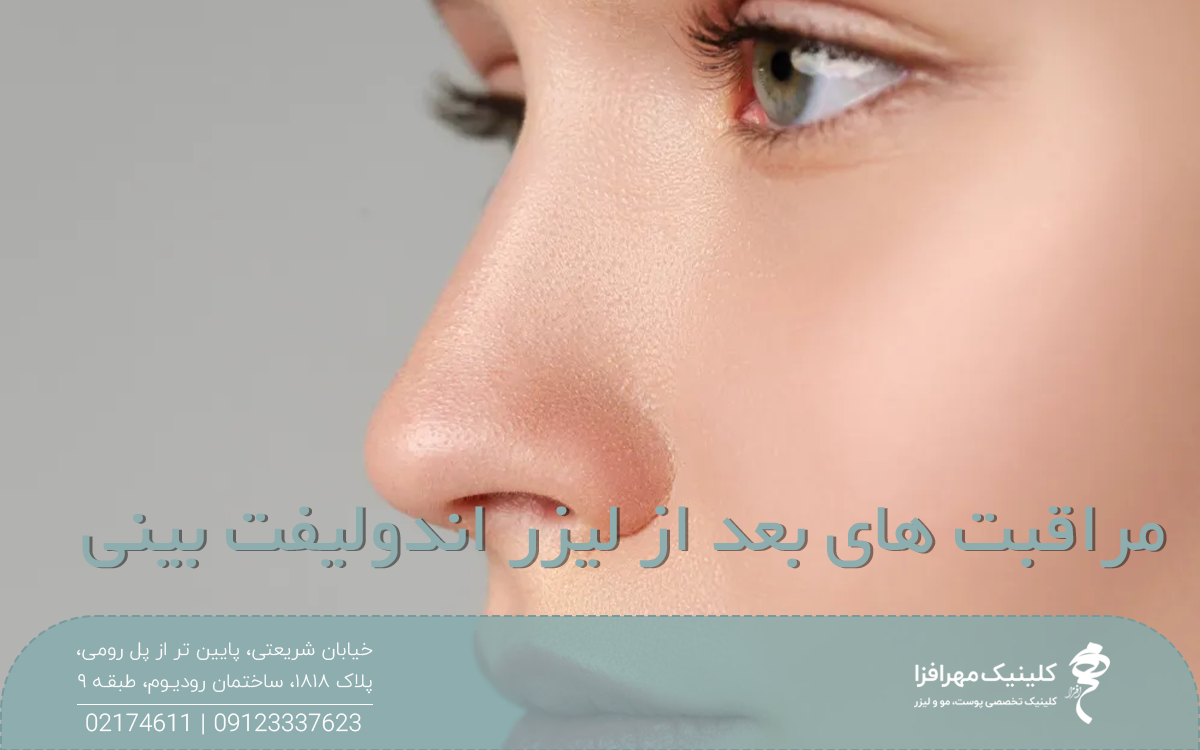 عکسی از نیمرخ فردی که بینی خوش فرمی دارد و به رو به رو نگاه میکند و روی عکس نوشته شده مراقبت های بعد از لیزر اندولیفت بینی