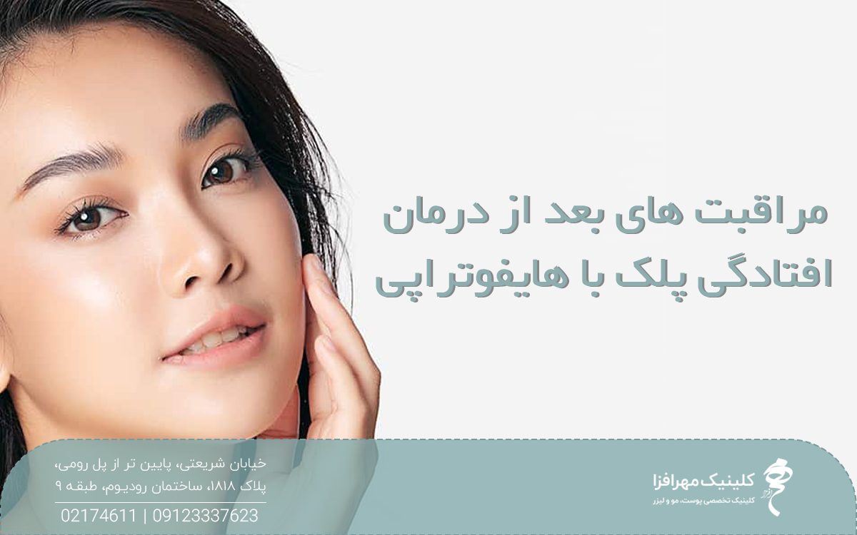 خانم خوشحالی که سرش را کج کرده است و دست خود را زیر چانه اش گذاشته است و روی عکس نوشته شده مراقبت های بعد از درمان افتادگی پلک با هایفوتراپی