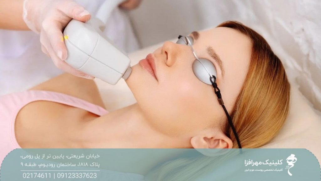 دختری که روی تخت لیزر است و اپراتور هندپیس را روی چانه او گرفته است