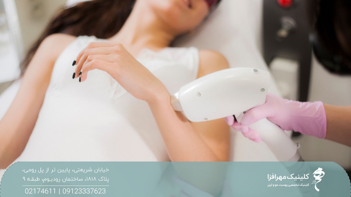 اپراتور لیزر که هندپیس را روی دست دختر نگه داشته است