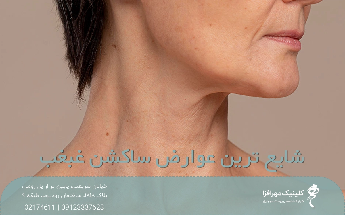 زنی که سرش را به یک سمت چرخانده و از بینی به پایین عکس گرفته شده است و روی عکس نوشته شده شایع ترین عوارض ساکشن غبغب
