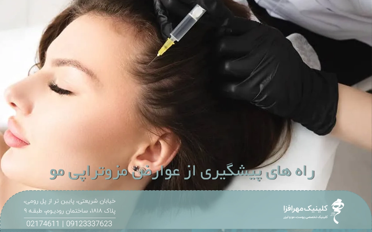 دختری که چشم خود را بسته و پزشک سرنگ مزوتراپی مو را روی شقیقه دختر قرار داده است