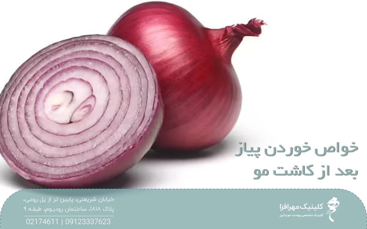 عکس یک پیاز قرمز نصفه در کنار یک پیاز قرمز درسته که روی عکس نوشته شده خواص خوردن پیاز بعد از کاشت مو