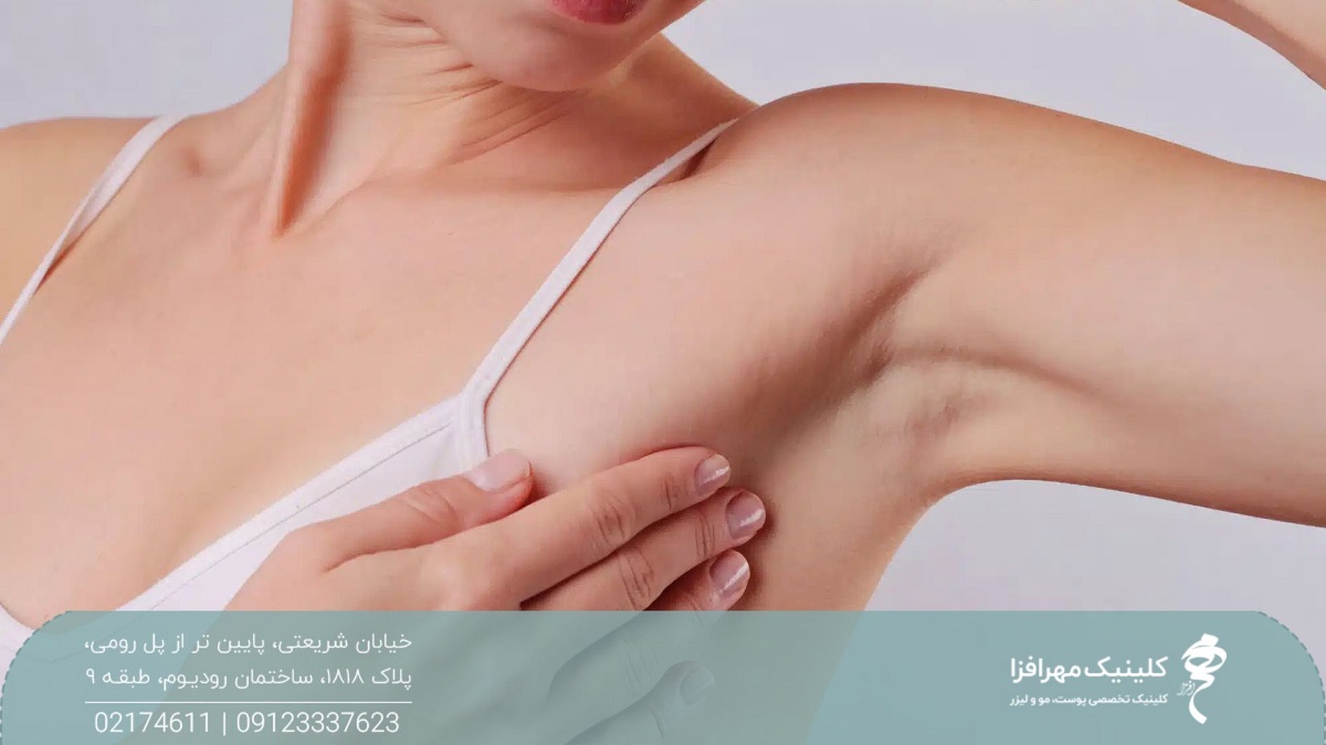 عکس زیربغل زن