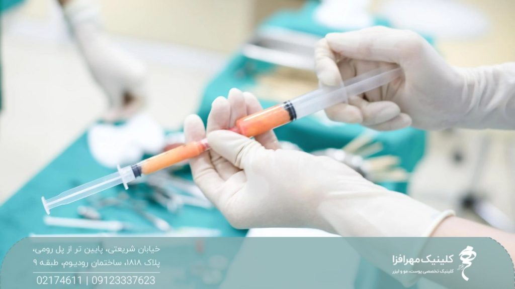 پزشکی که یک سرنگ حاوی چربی را در دست گرفته است و روی میز جلوی او ابزارهای جراحی و پزشکی قرار گرفته است