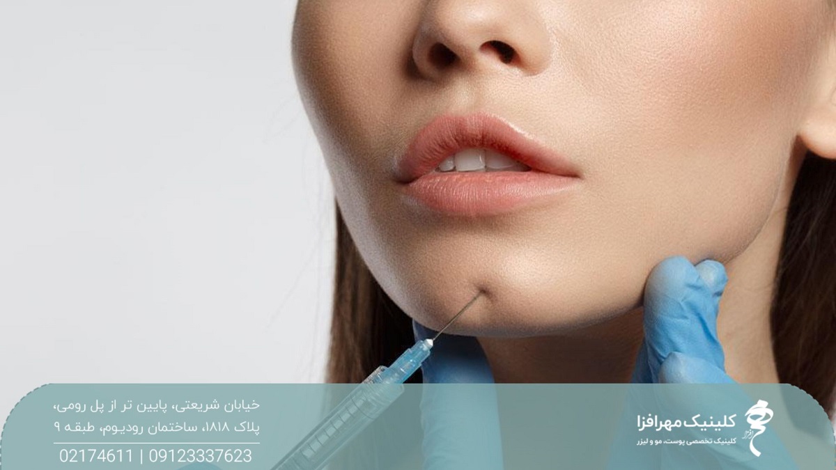 چانه دختری که پزشک سرنگ ژل را در آن فرو برده و به چانه او فیلر تزریق می کند