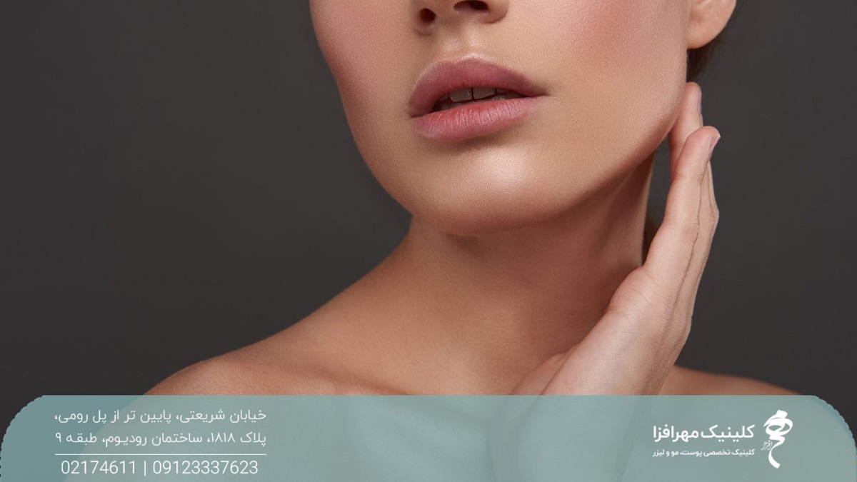 عکس از نیمه پایین صورت دختری که دست خود را کنار فکش گرفته است