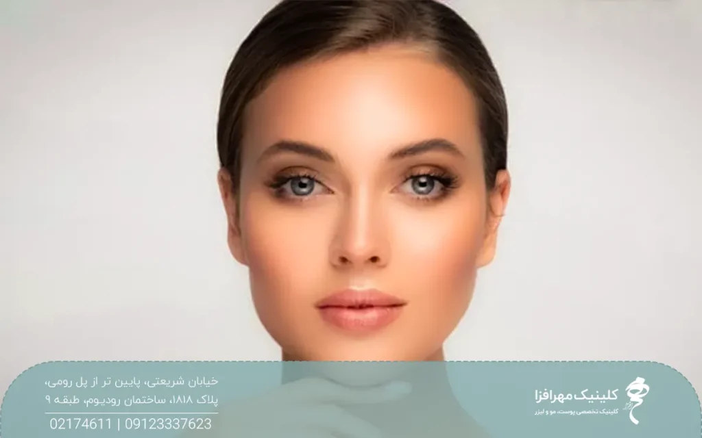 خانم زیبایی که دستش زیر چانه اش است و به رو به رو نگاه می کند