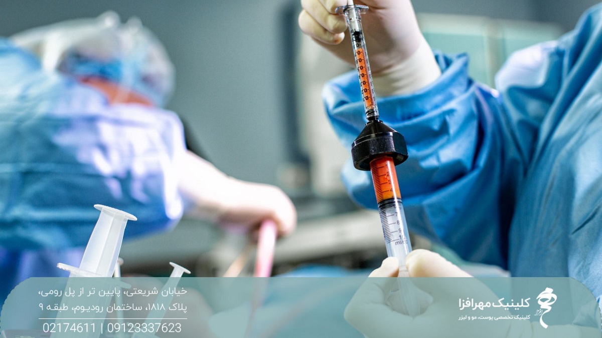 پزشک داخل اتاق عمل که یک سرنگ حاوی چربی استخراج شده از بدن فرد را در دست گرفته است