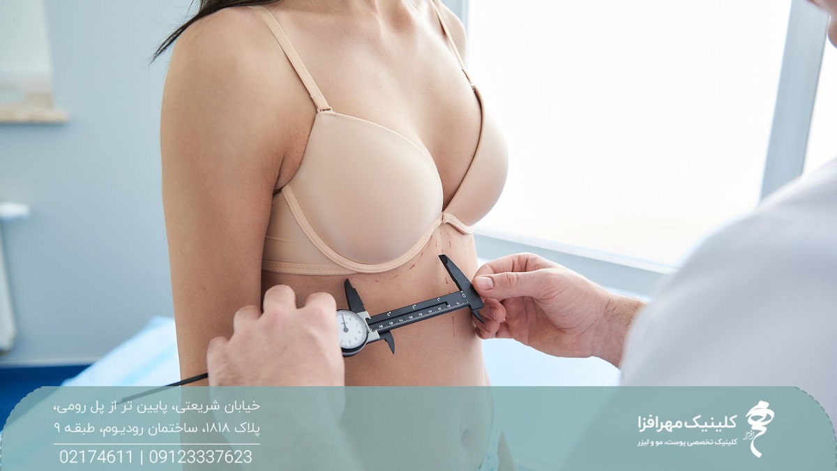 پزشکی که یک ابزار اندازه گیری را زیرسینه زن گرفته است