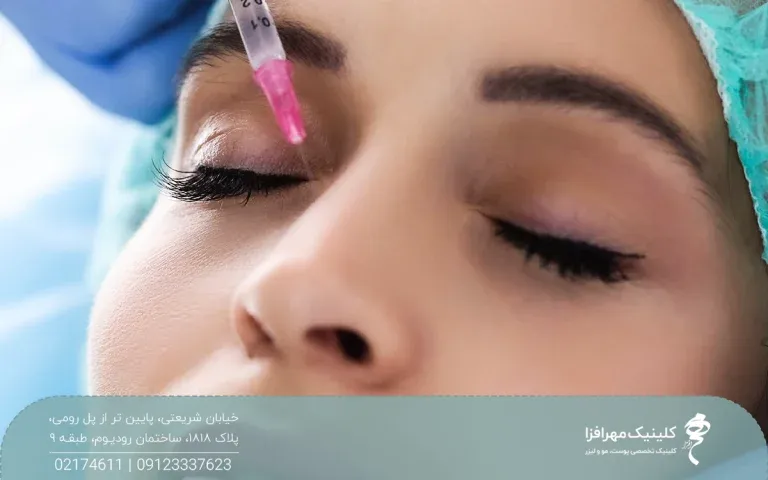خانمی که کلاه مخصوص به سر دارد و خوابیده است دست دکتری که از بالا آمده و در حال تزریق فیلر به بینی خانم است