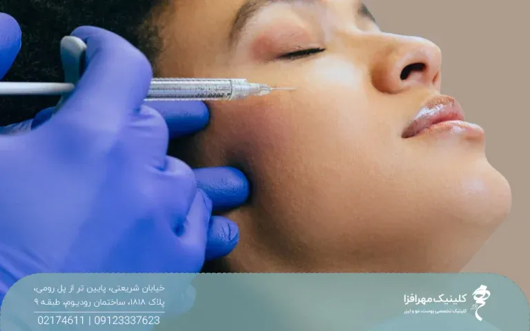 دست پزشکی که دستکش آبی دارد و در حال تزریق پروفایلو روی گونه خانم است