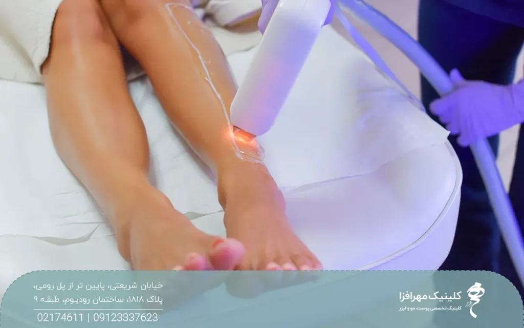 اپراتوری که در حال انجام لیزر پاهای فرد میباشد