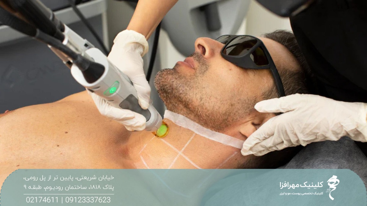 اپراتوری که روی گردن مرد چند خط رسم کرده است و نواحی بین خط ها را لیزر می کند