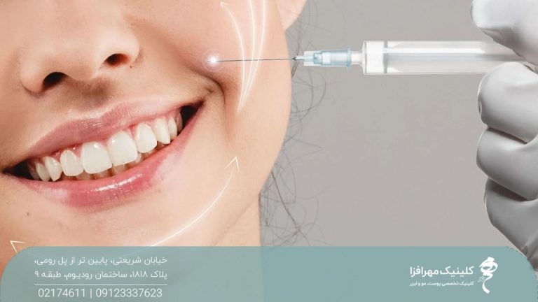 صورت دختری که لبخند زده است و پزشکی یک سرنگ را نزدیک خط خنده او گرفته است