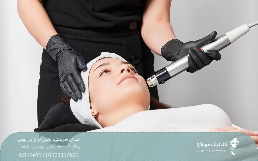 دختری که روی تخت خوابیده است و پزشک صورت او را میکرونیدلینگ کرده است