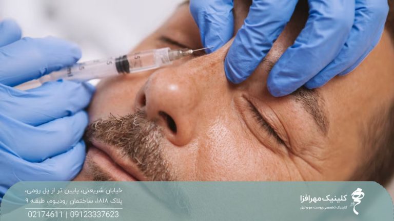 مردی که چشم خود را بسته و پزشک به پل بینی او فیلر تزریق می کند