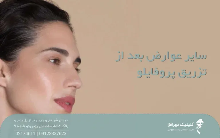 نیمرخ یک خانم زیبا و جوان که به یک سمت نگاه میکند