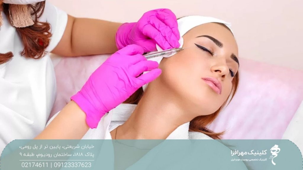 دختری که روی تخت دراز کشیده است و صورت خود را به سمت چپ گرفته است و پزشک به او مزوژل تزریق می کند