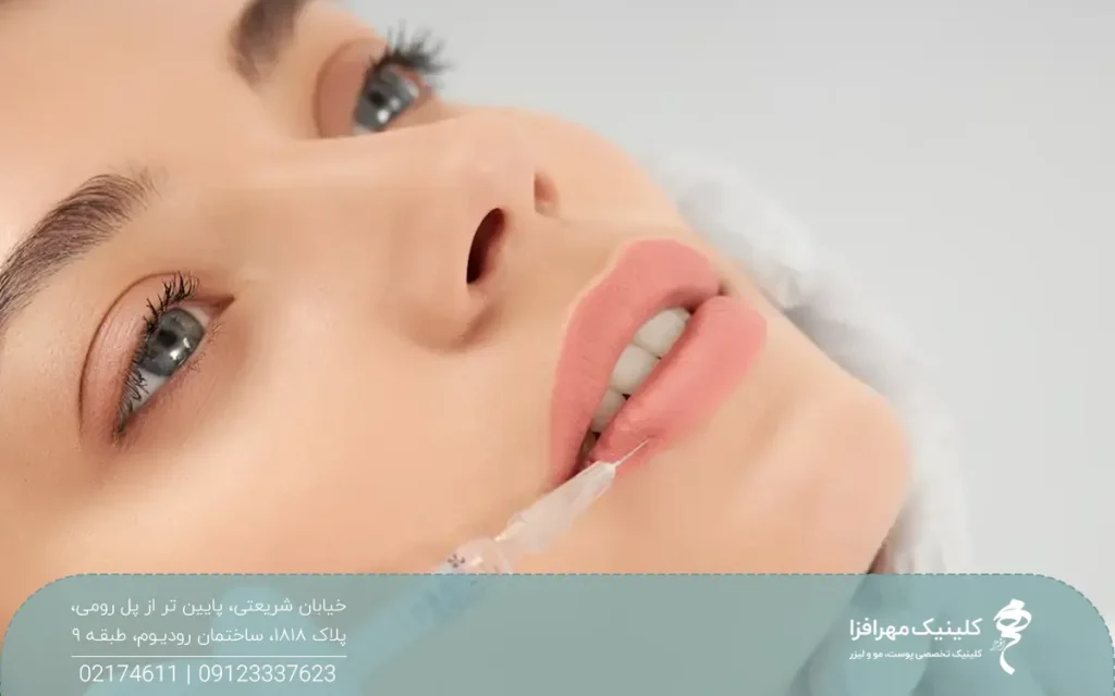 دختری که به یک سمت نگاه میکند و سوزن سرنگ حاوی ژل که در لبش فرو رفته است