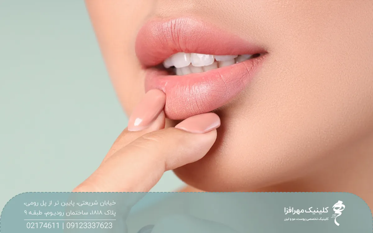 عکس از لبهای فردی که انگشت دستش روی لب هایش است