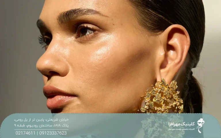 girl with defined cheek bones