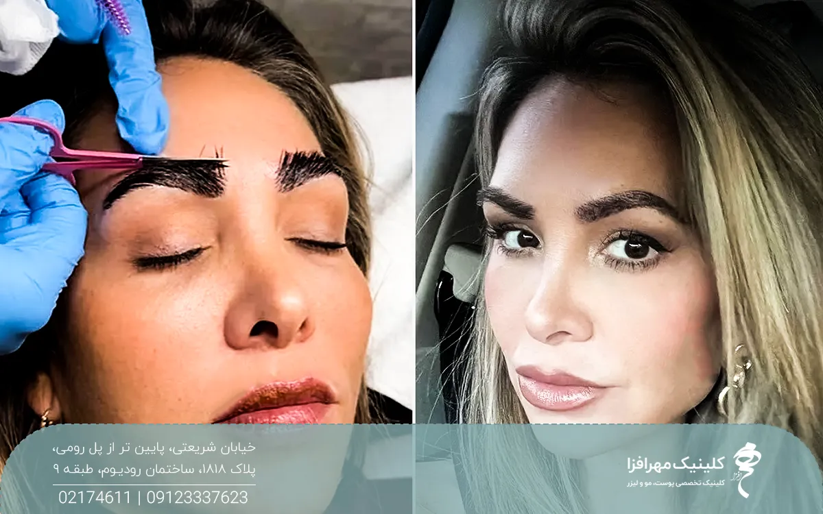 عکس از قبل و بعد قیچی کردن ابروی دختر