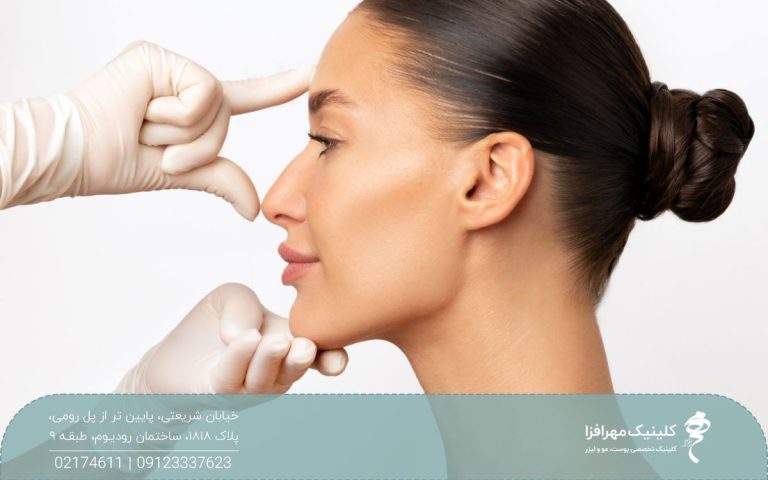 عکس نیم رخ دختر با بینی استخوانی