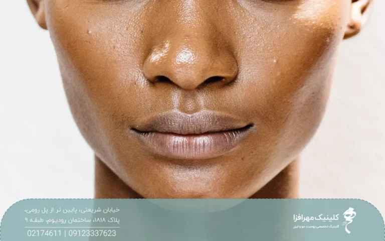 عکس از صورت فردی که گونه های برجسته و زیبایی دارد
