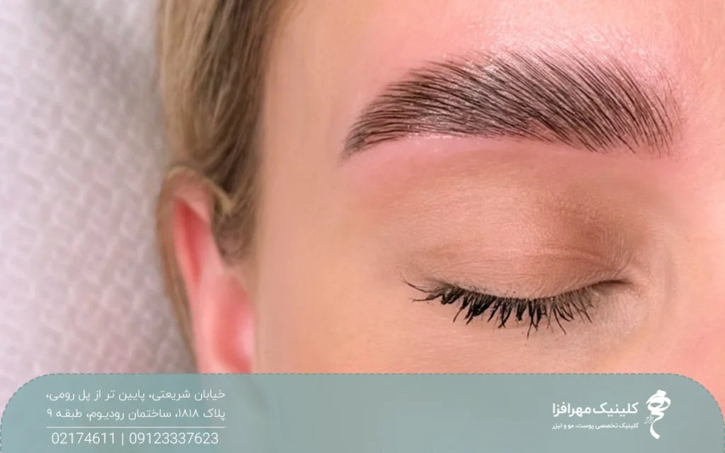 چشم راست دختر با ابروی صخیم که چشم خود را بسته است