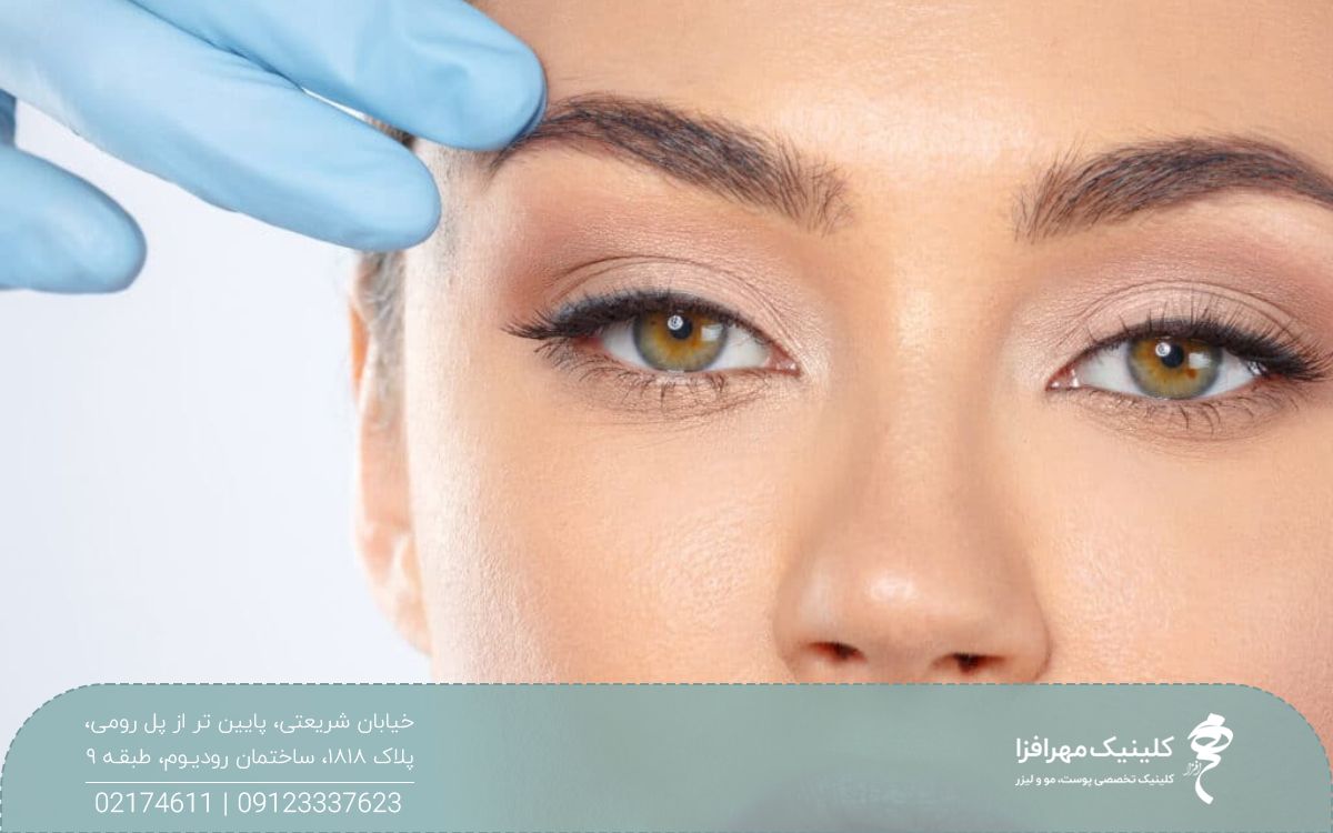دست پزشک که انگشت خود را روی ابروی دختر گذاشته و ابروی او را به بالا کشیده است