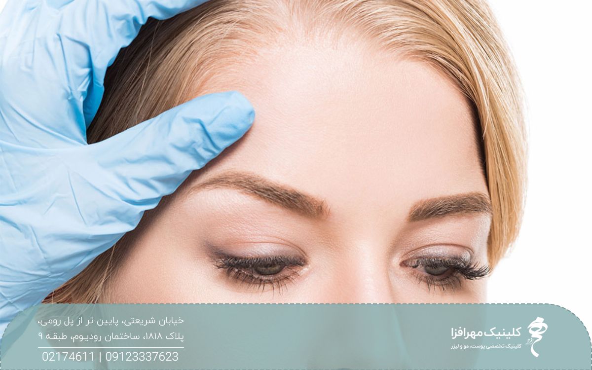 دختری که پزشک دست خود را روی پیشانی او گذاشته و انگشت شصت او بالای ابروی دختر است