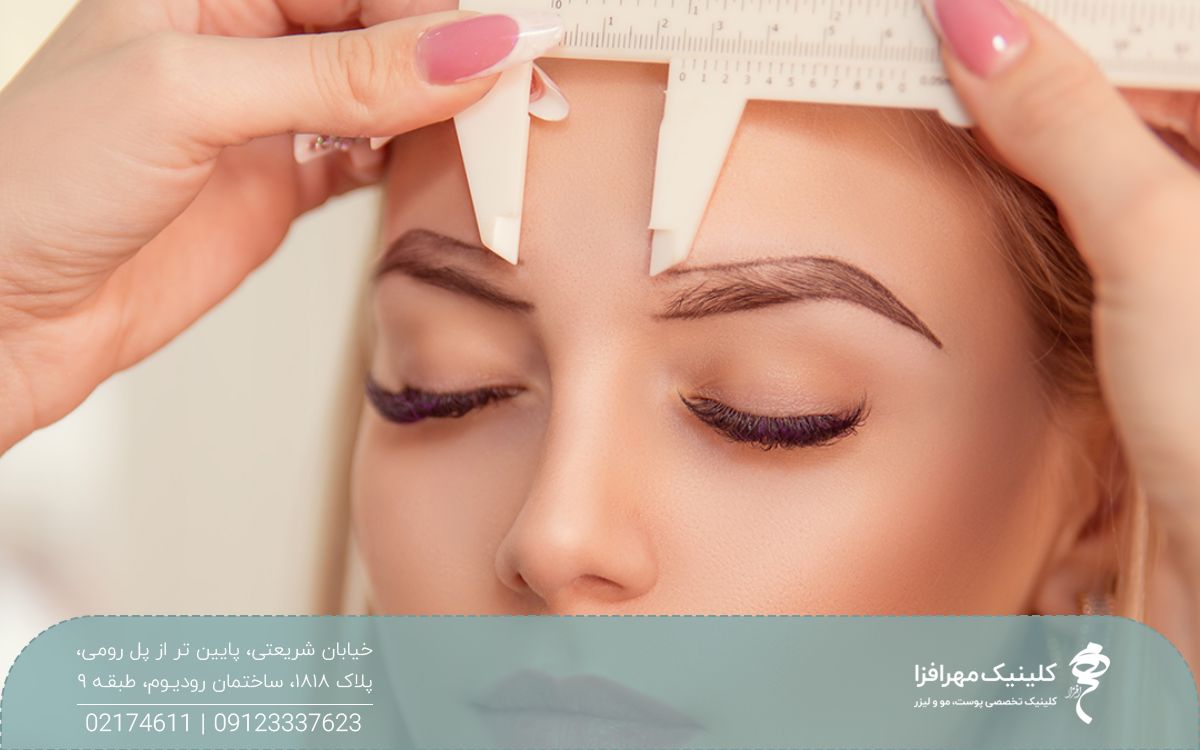 پزشکی که با خط کش قرینه سازی ابروهای دختر را طراحی می کند تا کاشت انجام دهد