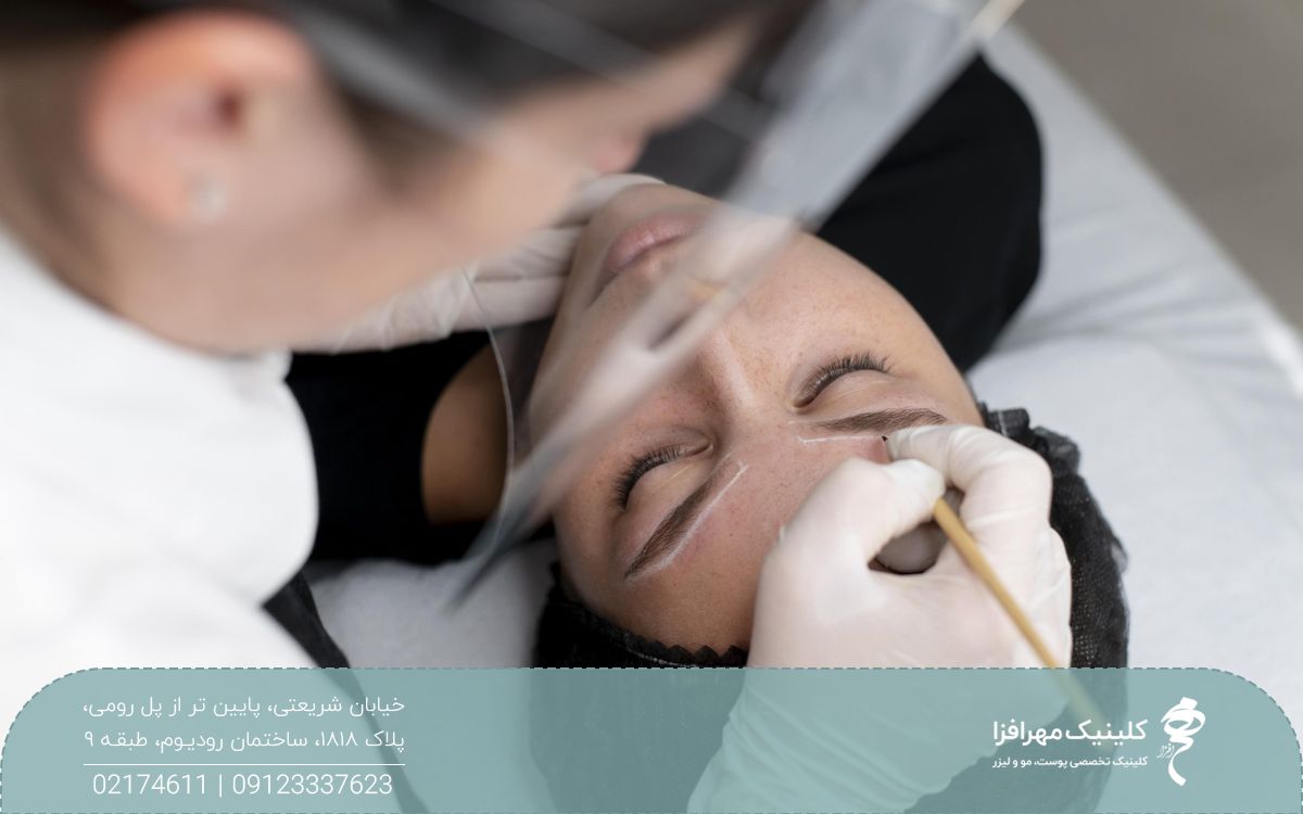 دختری که روی تخت کلینیک دراز کشیده و پزشک روی ابروهای او با مداد سفید طراحی انجام می دهد تا برای او ابرو بکارد