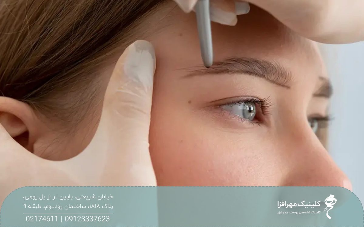 عکس نیم رخ از صورت دختری که متخصص کاشت، ابروهای او را بررسی می کند