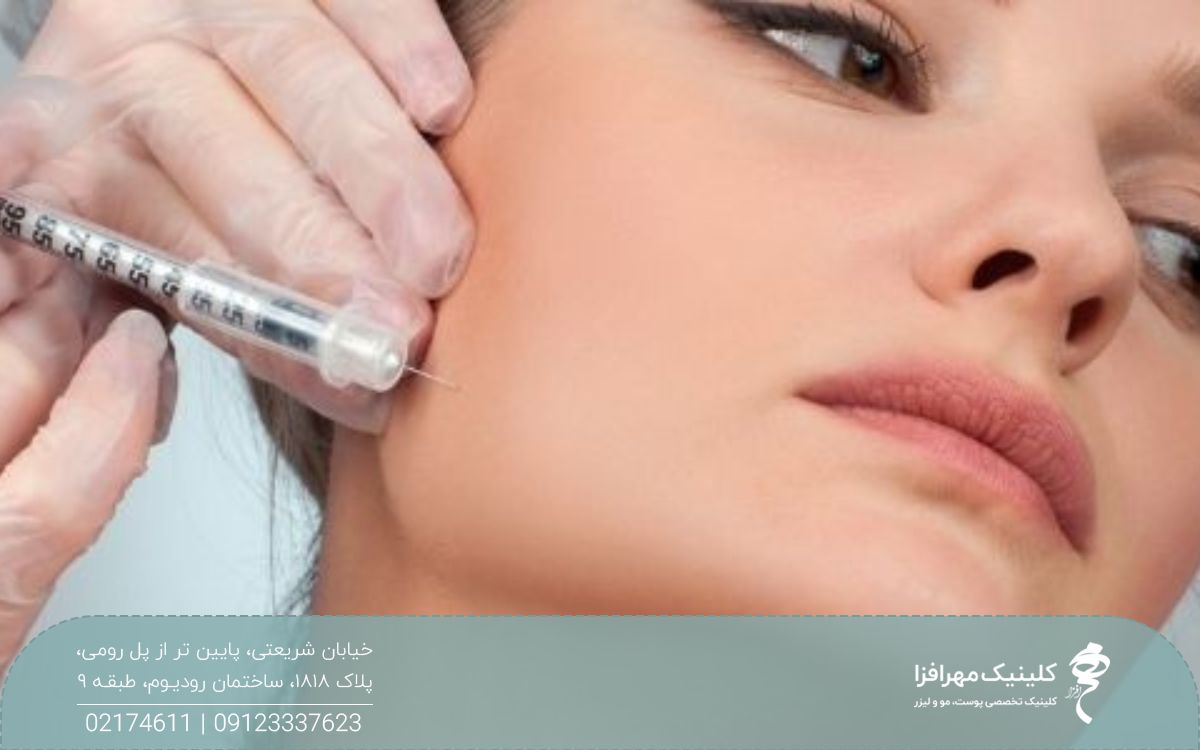 دختری که صورت خود را به یک طرف متمایل کرده و و پزشک به اطراف فک او فیلر تزریق می کند