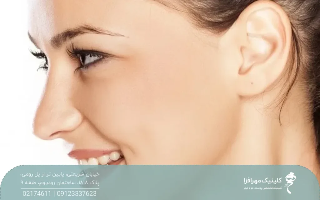 عکس نیم رخ صورت دختری که لبخند زده است