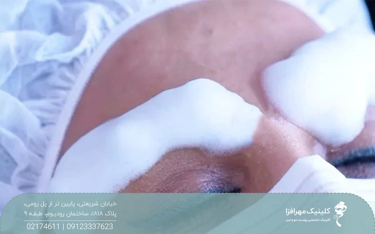 فردی که کلاه مخصوص به سر دارد و روی ابرو هایش کف است و مشغول شستشوی ابروهای خود است